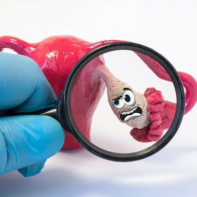 همه چیز درباره تنبلی تخمدان و درمان آن